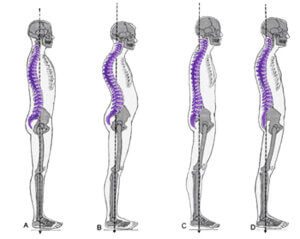 back-pain-blog
